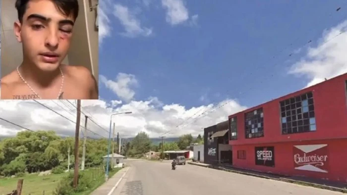 6996dfa67ed57_700_394!